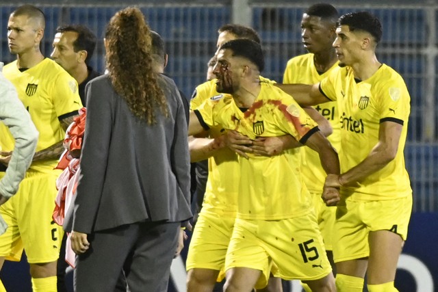 Maxi Oliveira após ser atingido por uma pedra por torcedor do Rosario Central 